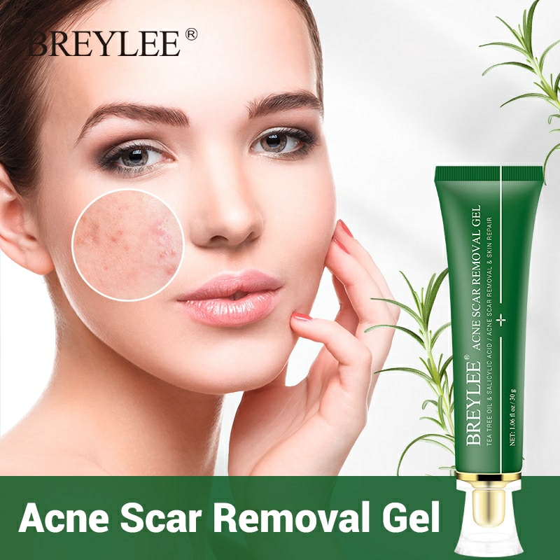 BREYLEE Acne Treatment Gel Price in Bangladesh